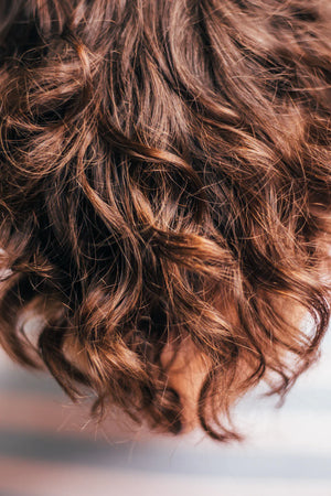 Is Hair Transplantation Right for You