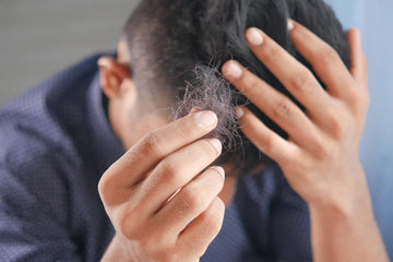 Effective Minoxidil Treatments for Men's Hair Regrowth