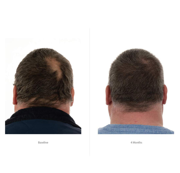 FOLIGAIN Triple Action Conditioner For Thinning Hair For Men with 2% Trioxidil
