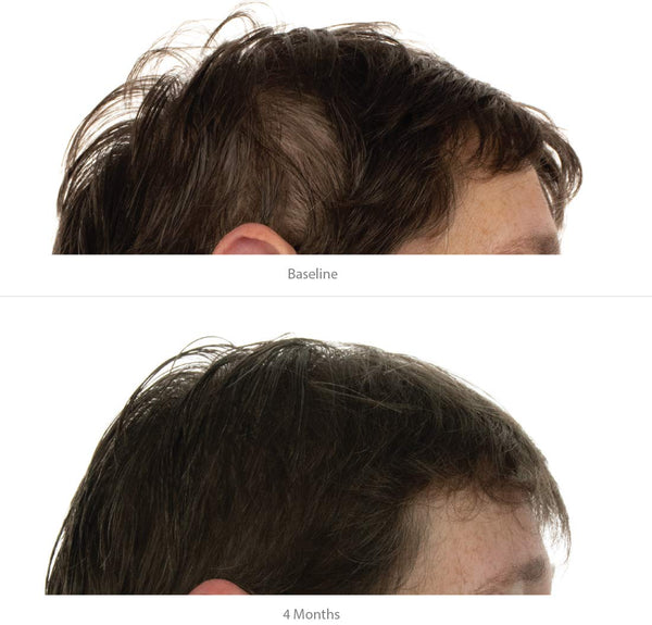 FOLIGAIN Triple Action Conditioner For Thinning Hair For Women with 2% Trioxidil
